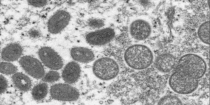 Molécula de viruela del mono Foto: BBC